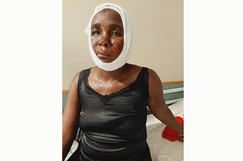Panga attack survivor relives ordeal