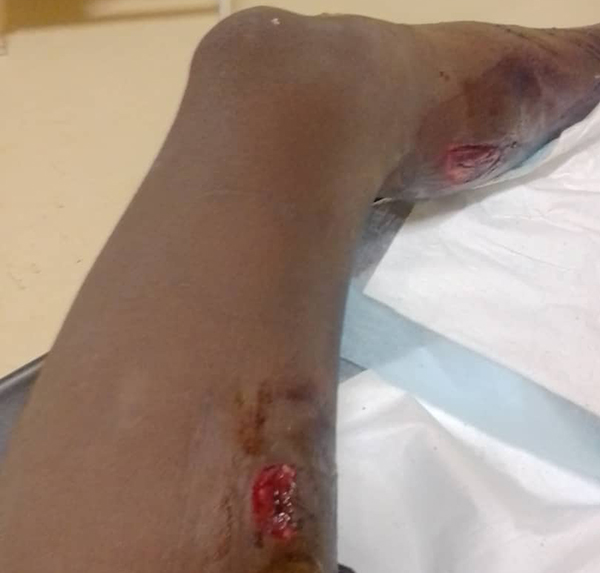 Teen attacked by hippo in Kavango River