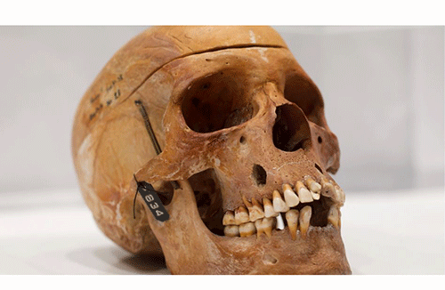 French university to return human remains
