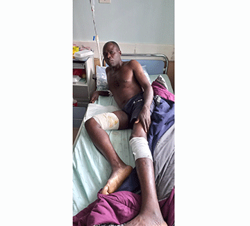 Rundu man survives croc attack