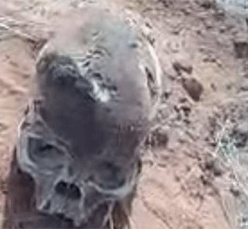 human remains2 Human remains discovered at Aminuis