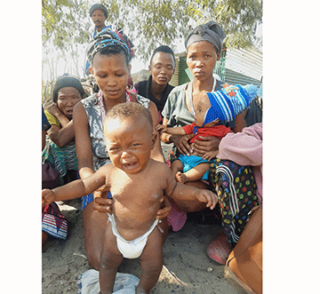 San community battles scabies