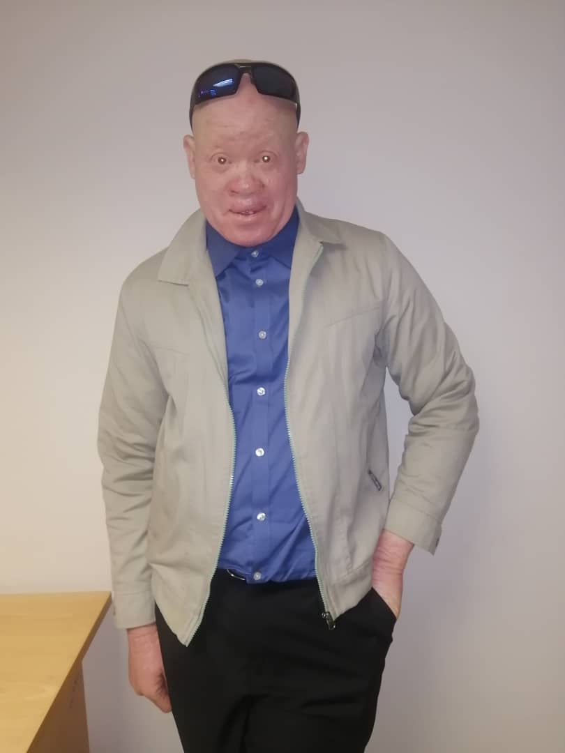 albinos Ovanaulema voshipa va halulwa koukongo weexwiki noipanyala