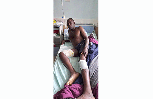Rundu man survives croc attack