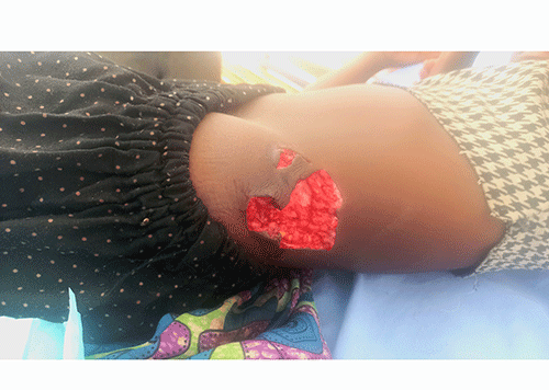 Brother wrestles croc to save sister