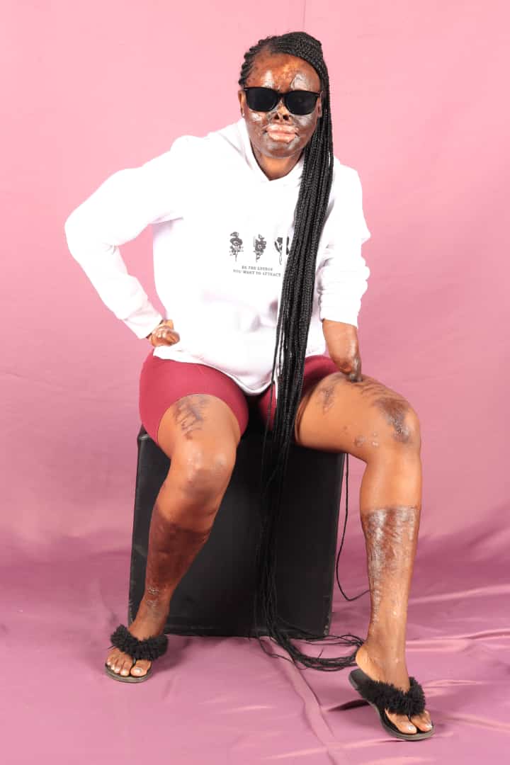 Fire victim demands justice