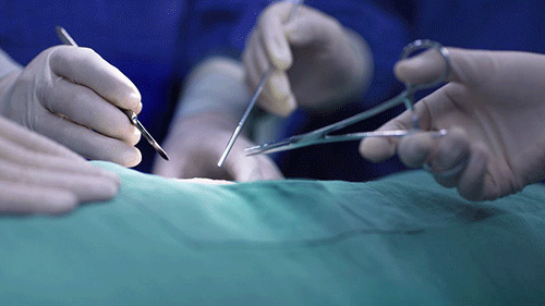 Smart cut figures rising