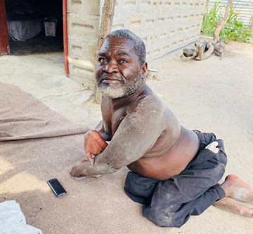 samaritans 2 Donations roll in for polio survivor