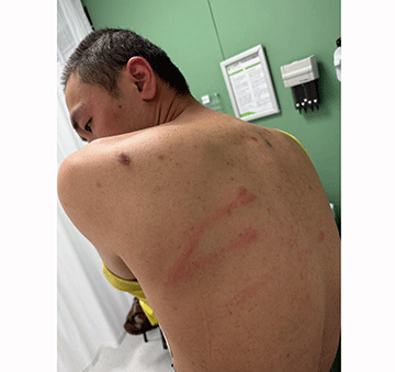 zheng 3 Chinese accused claims assault in custody