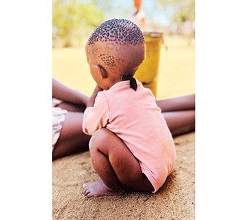 Malnutrition stunts childrenís growth