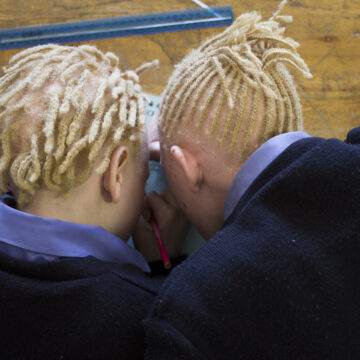 NM20150611024.jpg 38 000 Namibians live with albinism