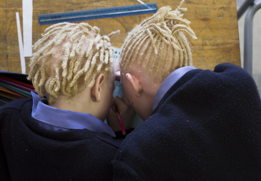 38 000 Namibians live with albinism