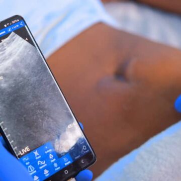 Handheld sonar Osaat Africa launches handheld sonar probe … Groot Aub’s first area to be accessed