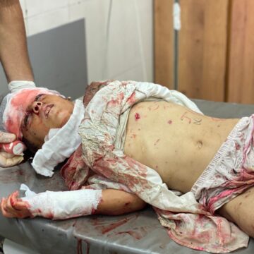 NGOs urge end to US backed Gaza aid system