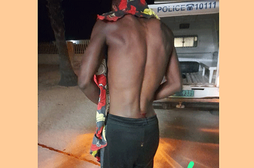 attacked-by A monifwa oshiponga kondjabameva