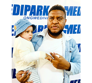 Burn-Wound-campaign Namibia a didilikwa e na 80% yoixupe yomundilo