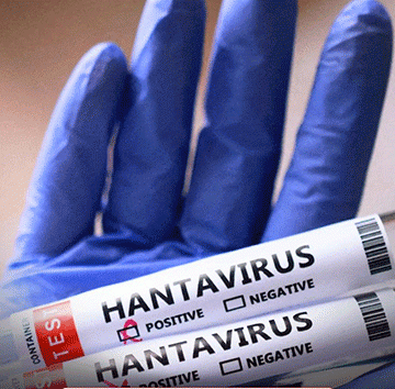 Govt assures nation amid global hantavirus concerns