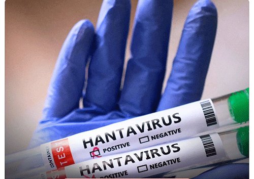Govt assures nation amid global hantavirus concerns